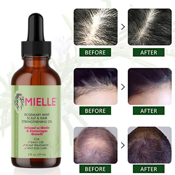 Hair Growth Essential Oil Rosemary Mint Hair Strengthening Oil Nourishing Treatment For Mielle Dry 100%Pure Hair Care Essential