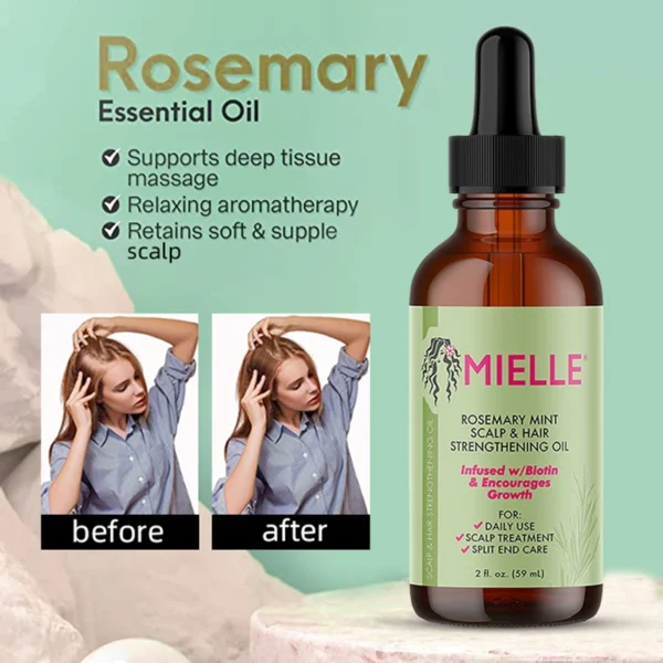 Hair Growth Essential Oil Rosemary Mint Hair Strengthening Oil Nourishing Treatment For Mielle Dry 100%Pure Hair Care Essential - Image 2